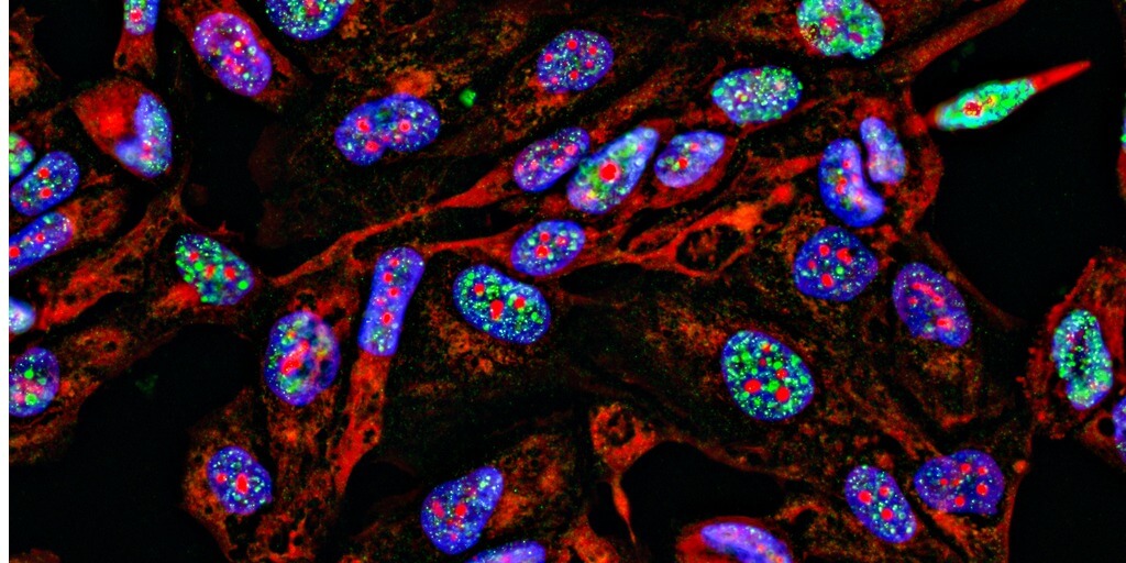 Immunofluorescent image representing high-throughput spatial genomics. Note: This image does not depict spatial genomics, but rather shows fluorescent staining of DNA damage foci.