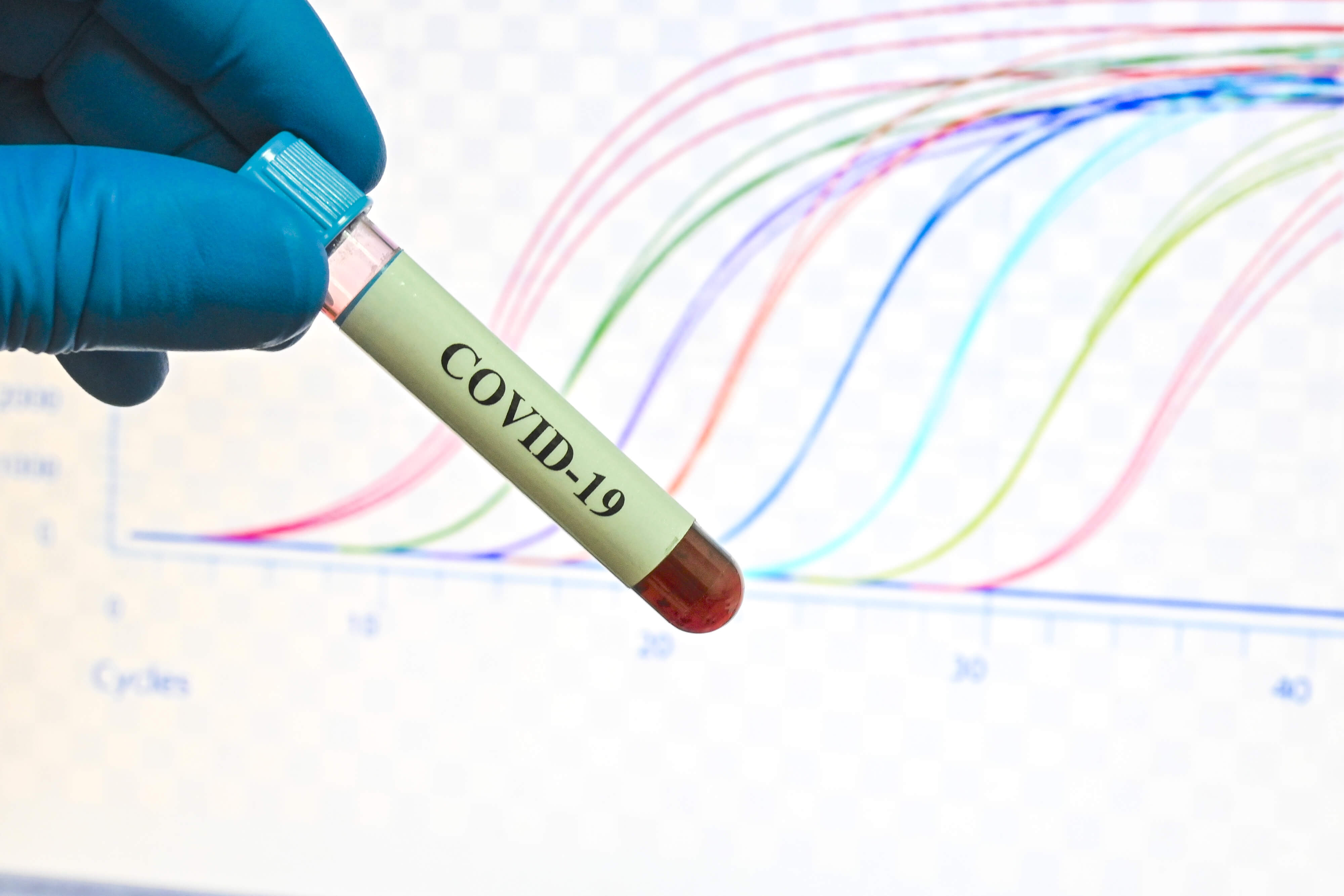 A qPCR result after a covid test