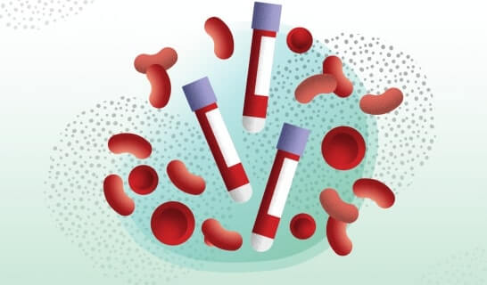 Thema der Fallstudien-Webseite: Den Fingerabdruck von Krebsmethylierung im Blutplasma aufspüren
